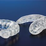 Minimising wear and tear of teeth with an occlusal splint