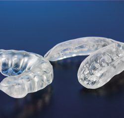 Minimising wear and tear of teeth with an occlusal splint