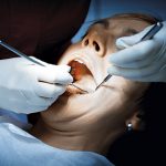 dentist examining a patients teeth