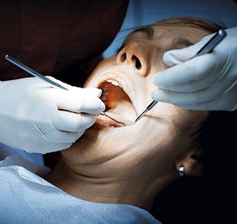 dentist examining a patients teeth