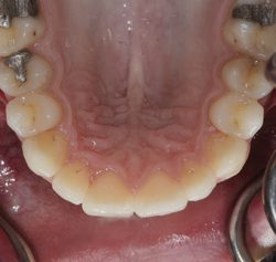 Fig 4c after alignment