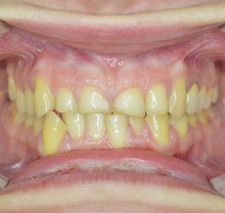 Fig 5 Emotional and physical stress are potential causes of bruxism