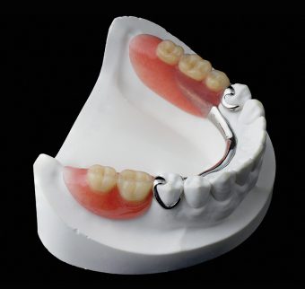 Removable partial chrome cobalt denture