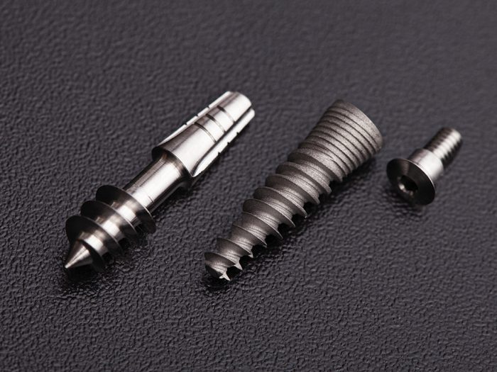 Zirconia implants an alternative Ireland's Dental Magazine