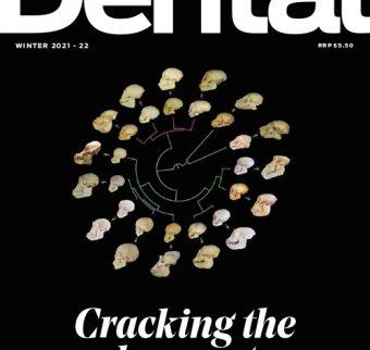 Cracking the molar mystery